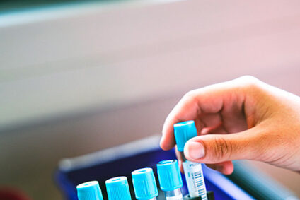 Information importante concernant la réalisation des Groupe Sanguin et/ou RAI